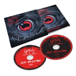 Obituary – Cause of Death - Live Infection