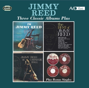 Ronnie Wood Band – Three Classic Albums Plus