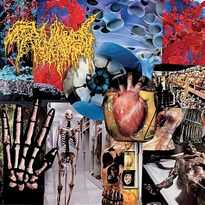 Trichomoniasis – Harvest of the Killing Fields