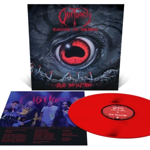 Obituary – Cause of Death - Live Infection