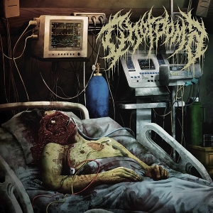 Chordoma – Chordoma